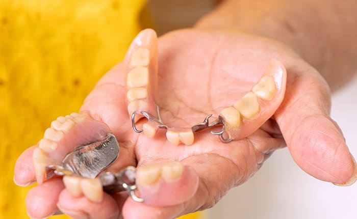 failed-teeth-m Failed implants